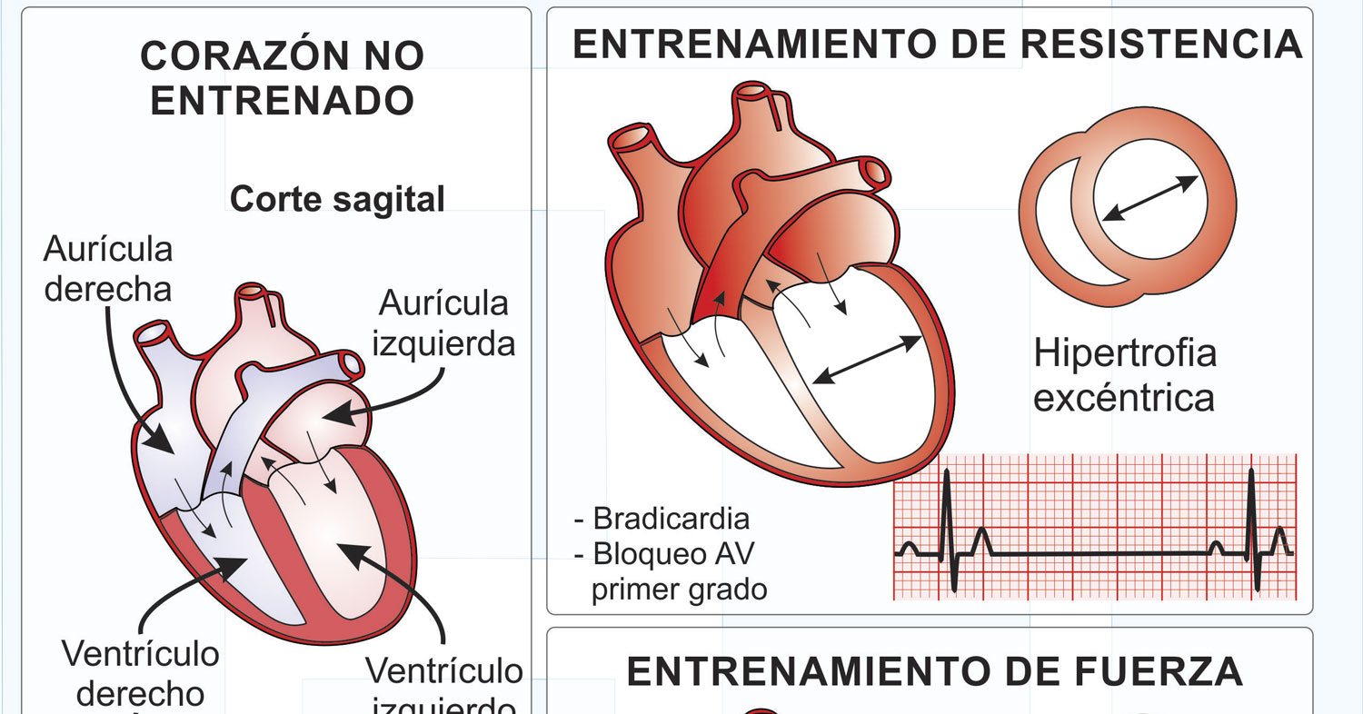 Infografía - Adaptaciones cardiacas al entrenamiento