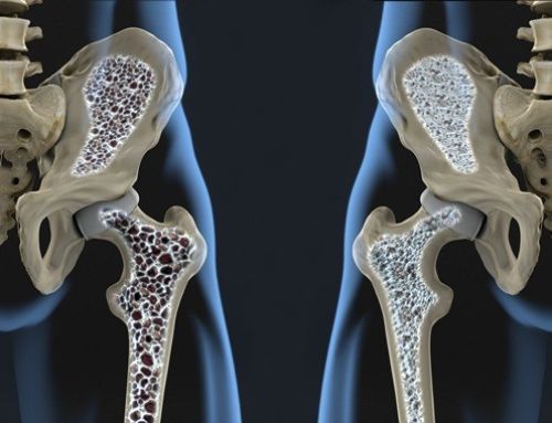 Impacto de diferentes modalidades de entrenamiento sobre la densidad mineral ósea en mujeres postmenopáusicas