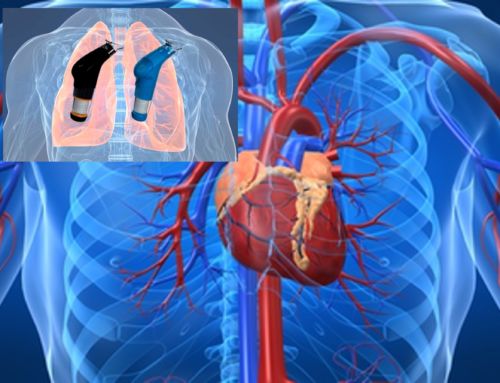 Debilidad de los músculos inspiratorios en patología cardiovascular: implicaciones en la rehabilitación cardiaca